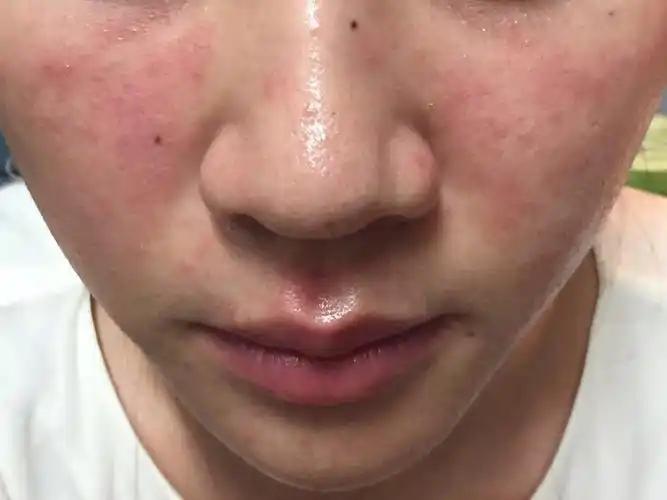 面膜什么牌子好,补水效果好的护肤品,护肤,过敏