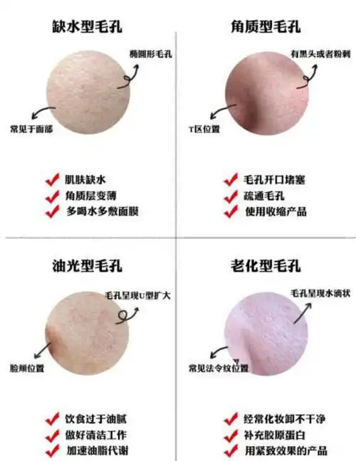 高圆圆新剧暴露皮肤问题毛孔粗大遮不住女神也难逃中年危机