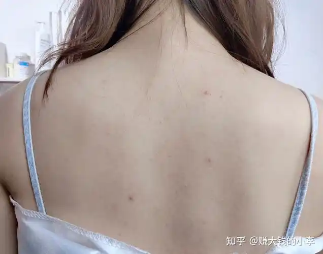 3, 干净后背——洗出好皮肤