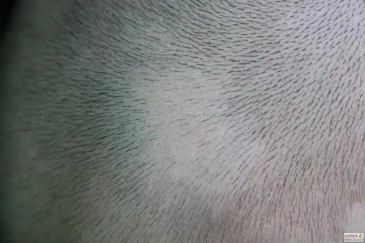 请教李博士,15个月小孩,头皮白癜风如何治疗?