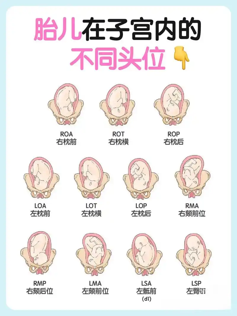 我家一个头位一个臀位 6月前·贵州 0 分享 回复 闪光的文字6601