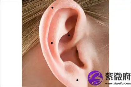 耳朵背后长痣是好痣还是恶痣