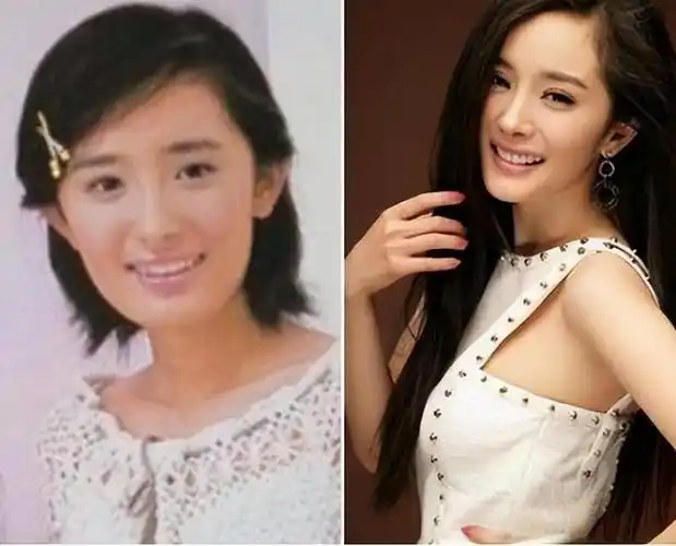 基因成了"照妖镜",7位明星整容"改命",孩子却跟整容前一样|杨幂|戚薇