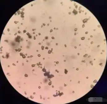 题目 题目详细a:三联磷酸盐结晶 b:胱氨酸结晶 c:尿酸结晶 d:固醇结晶