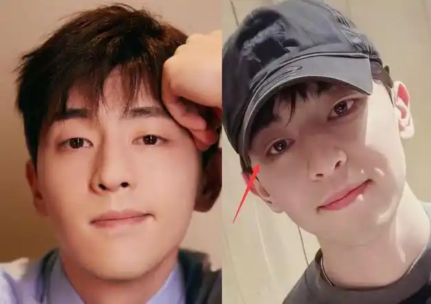 和之前对比下还是很明显的,有粉丝猜测邓伦不可能是去整容,可能是对方