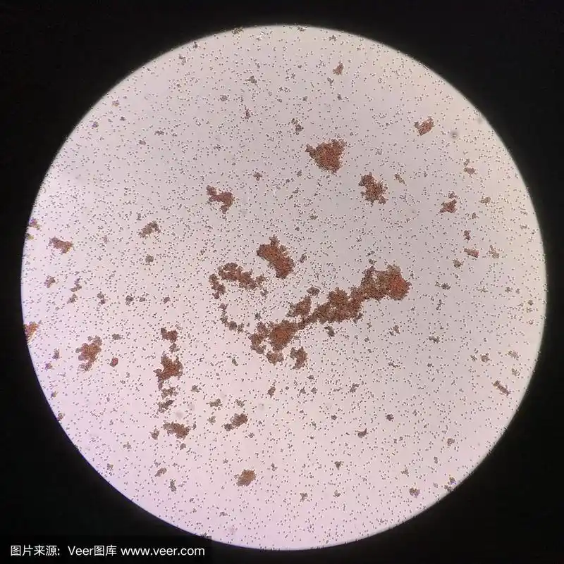 交叉配血试验中的红细胞凝集.用手机拍照.