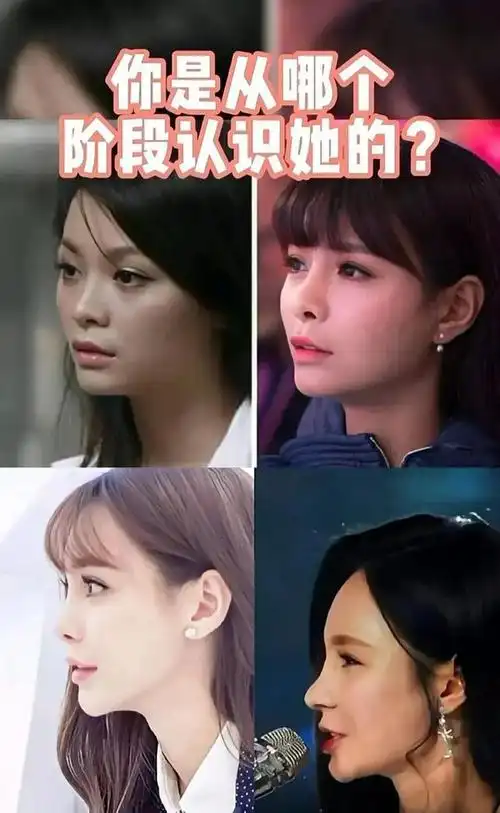 沈梦辰出道至今变化史堪称换头术这才叫教科书级整容