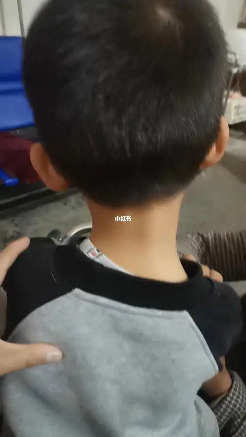 7岁的小朋友脖子歪了
