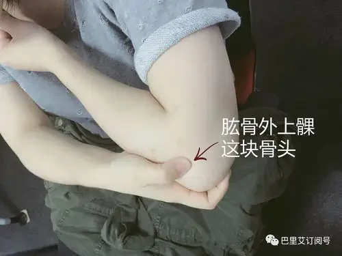屈肘找穴窍门:屈肘呈直角,肘横纹尽头处即是曲池穴的位置.