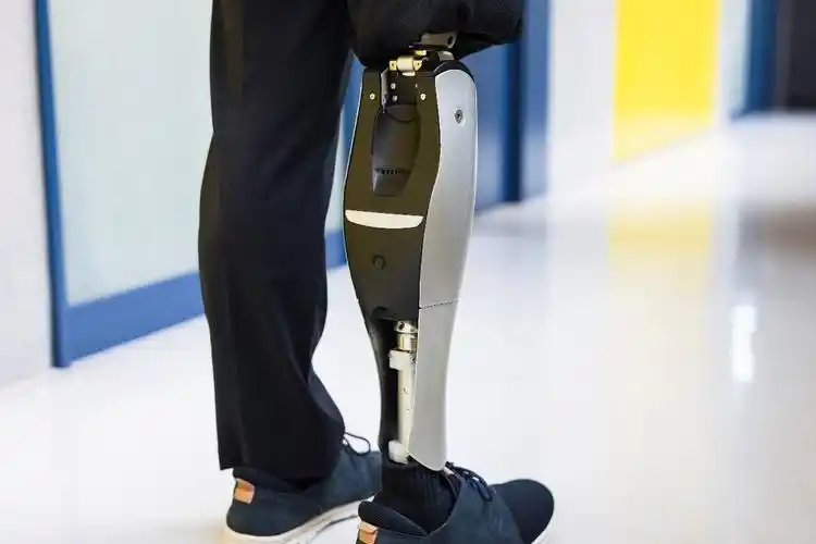 智能动力假肢,助力下肢截肢人群像拥有原生腿般自然行走