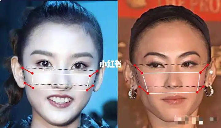 94简单易懂的判断颧骨高还是颧弓宽的方法?