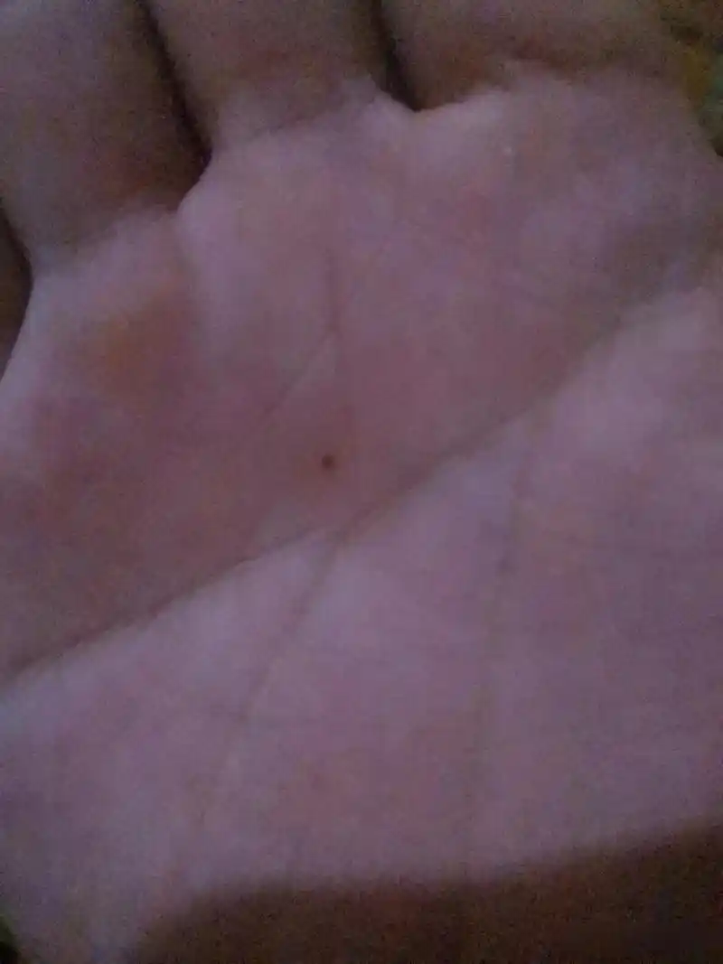 本以为是卡了灰尘,使劲刮了刮,和上次手掌心一样,又是痣,这里也算手指