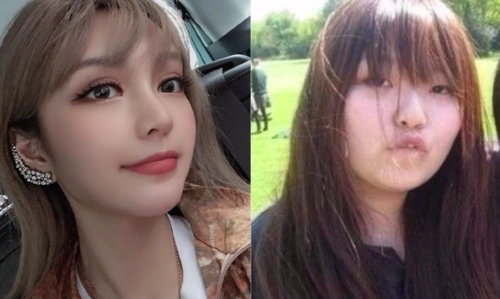 周扬青前后对比 喊话网友:我鼻子很贵