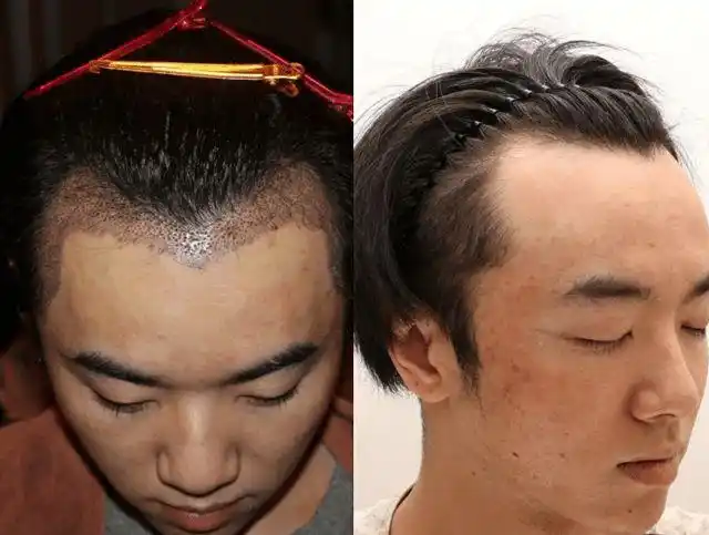 7月16日,有位微博名为"发发爱我2021"的网友,曝出华晨宇曾整容,植发