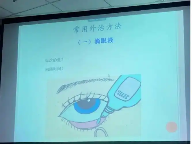 6015首先眼药水滴的部位是下眼睑(结膜囊),不是角膜—73怎么滴