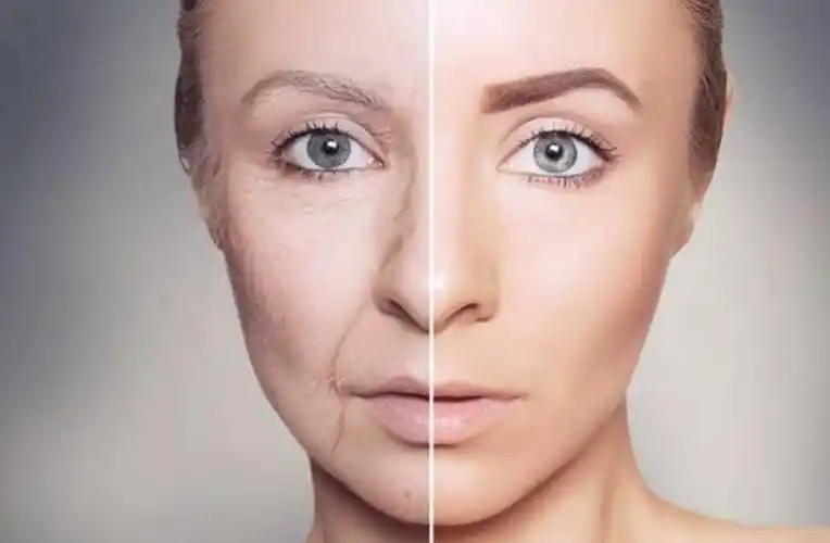 人老皮先松,皮肤松弛,是每个女人的噩梦.