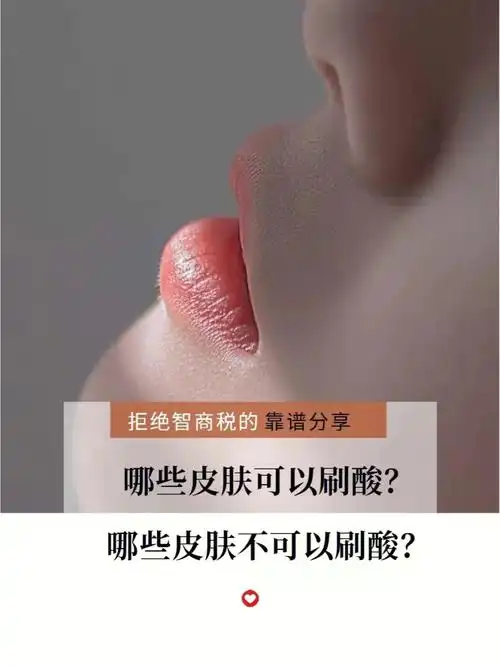 刷酸的文章 ,希望能帮到大家,不懂这方面问题的朋友  可以直接问我