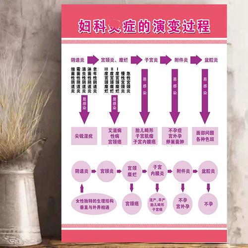 宫颈疾病示意图妇科常见病宣传画女性挂画妇科炎症演变过程海报图