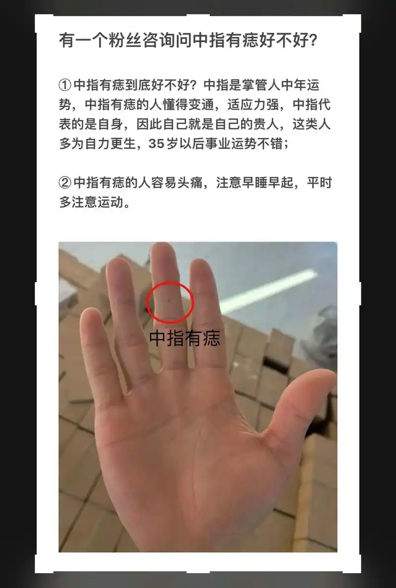 中指痣好不好!最重要中指有痣的人自尊心强!#国学文化 #手掌 - 抖音