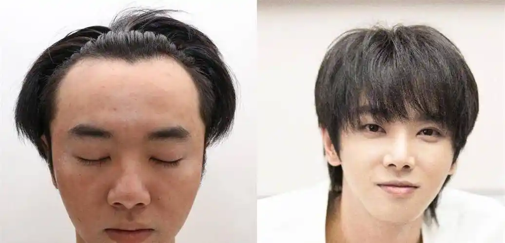 华晨宇承认图片是本人,但否认整容植发,张碧晨辟谣插足他人感情