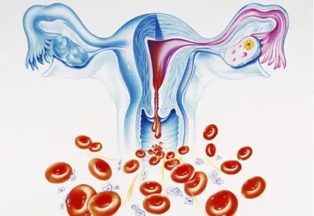 月经周期结束后为何会出现褐色分泌物关键是保持健康