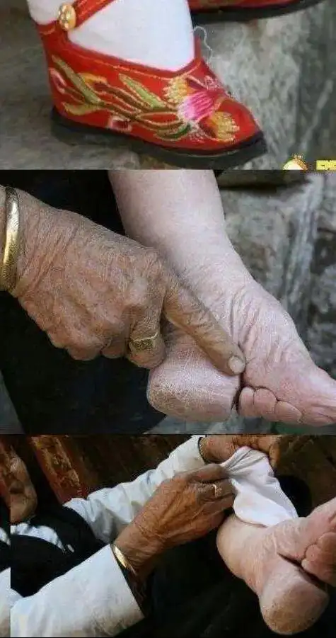 《红楼梦》未写缠足