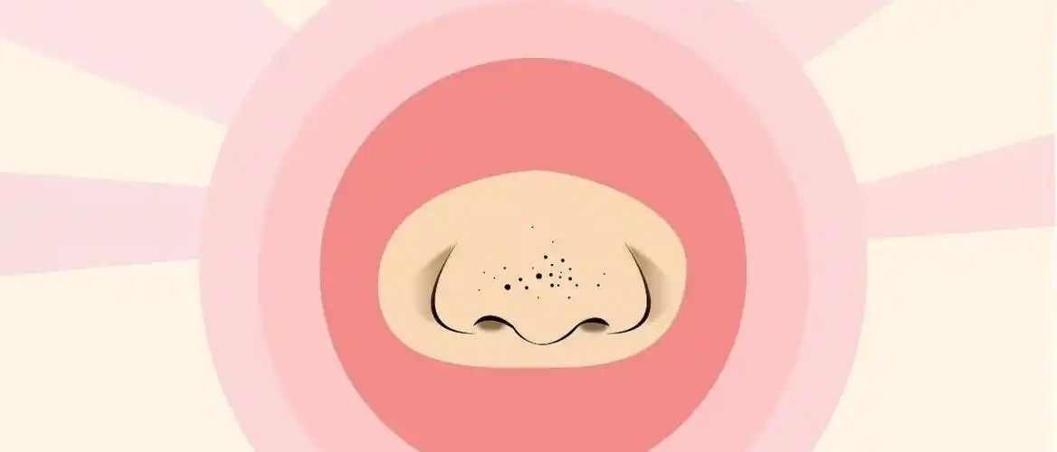 白头和黑头谁更让人"头疼"? - 知乎