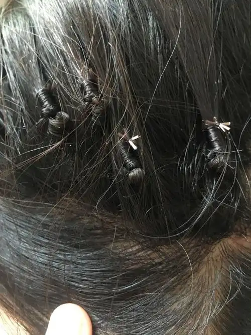 已经离开头皮了但是它一眼就能看出来而且白色发根也