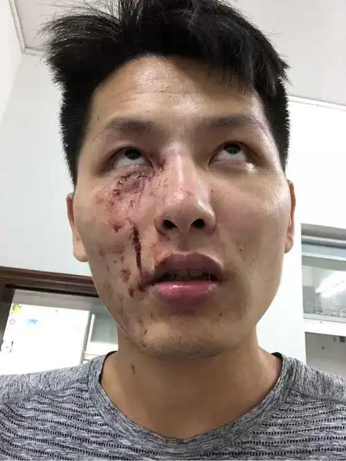 和不会打篮球的人打球什么体验?