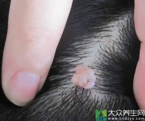 头上长这种肉疙瘩怎么办不管会不会越来越大