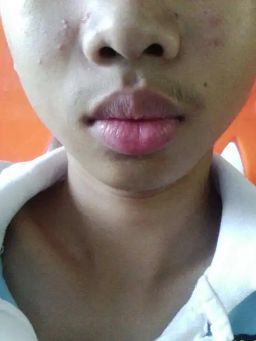 点击查看源网页