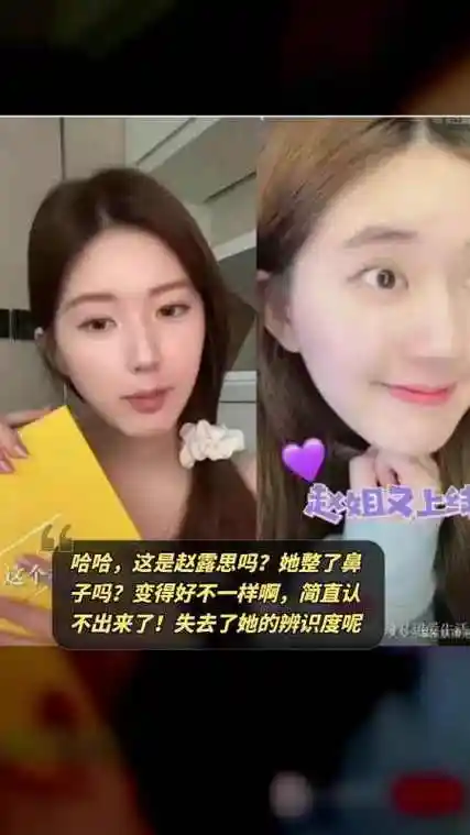 赵露思整容后变得面目全非