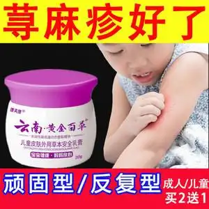 治疗婴儿童划痕荨麻疹过敏止痒根断专用药膏胆碱能性慢性丘疹去根