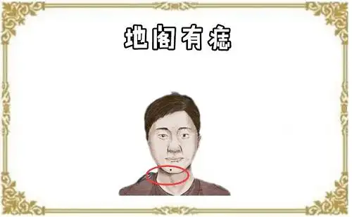 身上5颗巨富痣 身上5颗巨富痣图片_奇库网