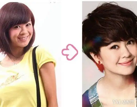 快女郁可唯整容前后对比娃娃脸竟是整出来的