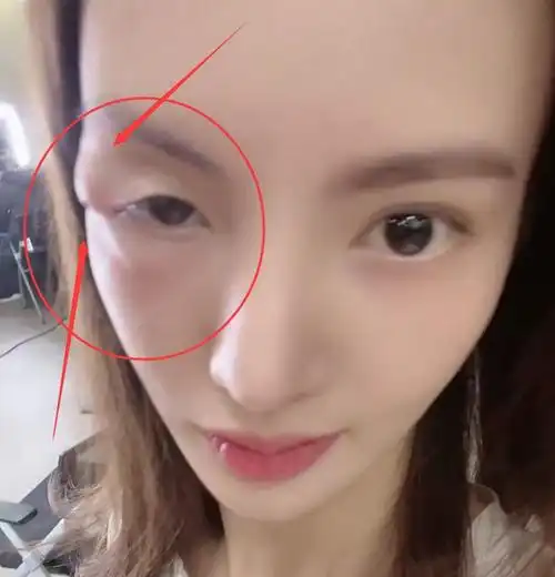 金晨被疑歪嘴后鼻子透光像蛇精回应视频才是真吓人