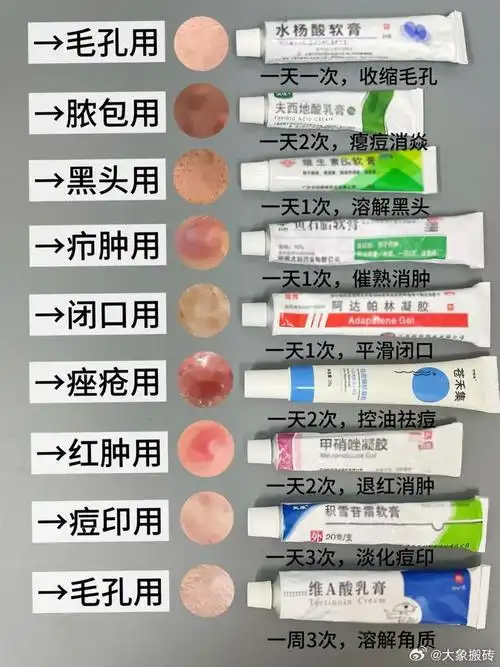 皮肤科门诊常用的10个小药膏,一文总结