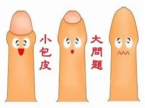 包茎组图图片