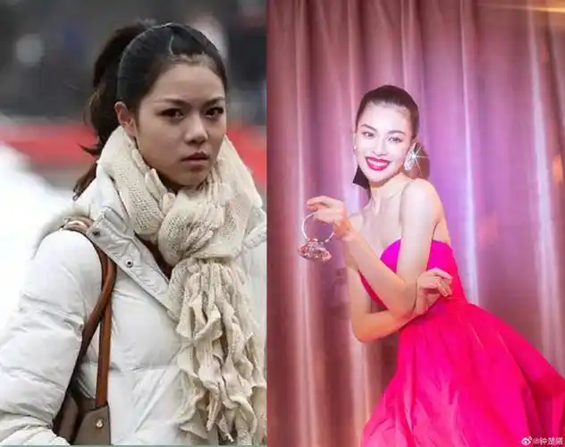 红毯女王钟楚曦出道至今判若两人,难怪网友都说她微调了