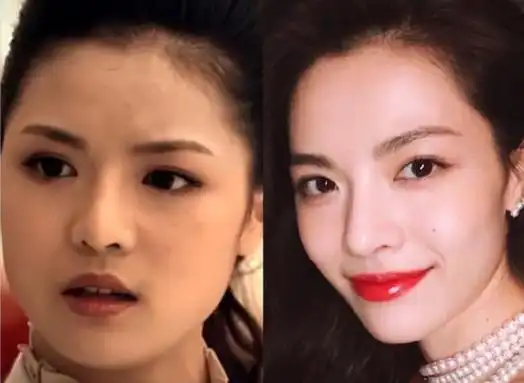 减肥拔牙长开了这6位艺人为整容而变美找的理由好离谱