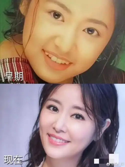 林心如脸型都发生了变化,唐艺昕直接变甜妹,笑起来特别好看,杨紫连