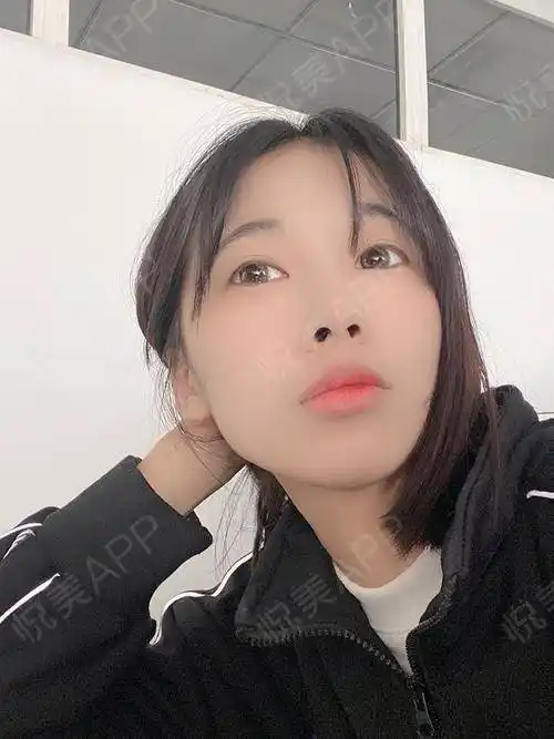 的,现在恢复了2个月的脸就好显脸小呀,而且小的脸蛋显得更加的精致,拍