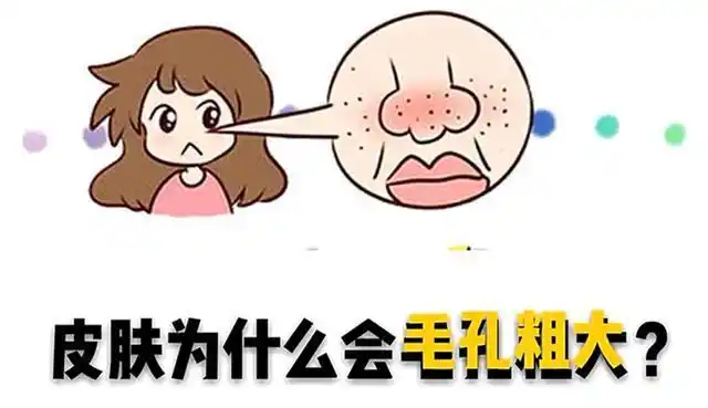 毛孔粗大皮肤显得粗糙,遇到这样问题如何改善?