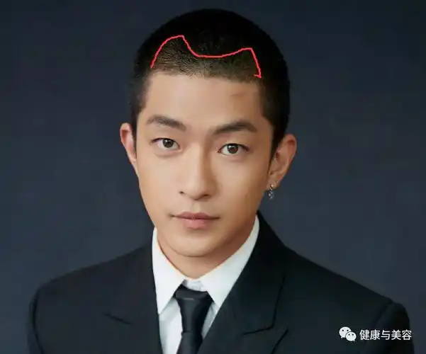 无论男生还是女生,在选择发型的时候,往往因为发际线的后退而非常尴尬