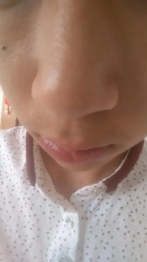 脸部皮肤差 用任何化妆品都起不到多大作用 清洁也做了 脸上粗糙 不