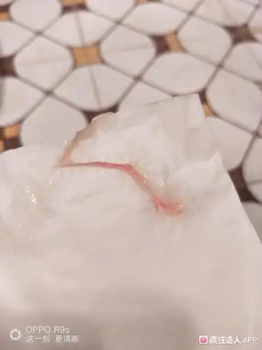 请问我这是排卵出血还是着床出血