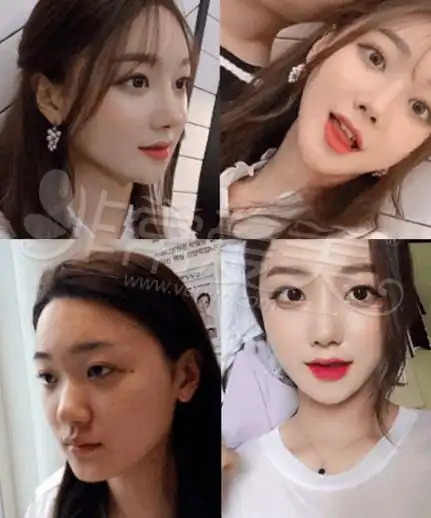 let美人韩国整容女许誉恩是哪一期后续怎么样