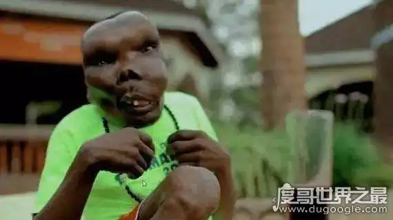 你以为的小眼睛,塌鼻子,大饼脸,招风耳等等,这些都只是小儿科,完全不