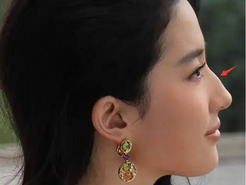 但是近期她的鼻子从侧面看去,却是直直的一条线.