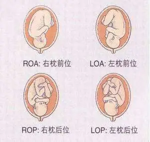 那我左枕横位是什么意思?